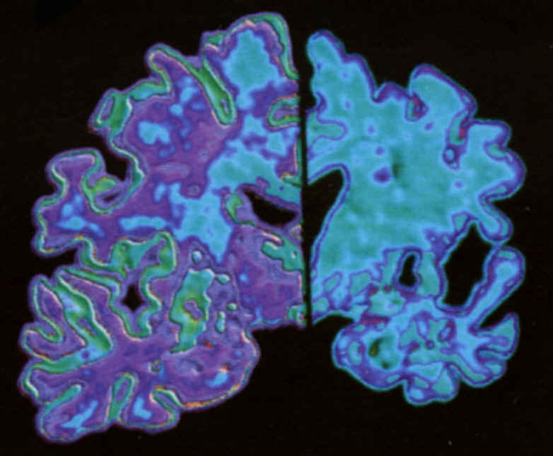 Drugs make you smarter photo 1