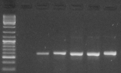Przykładowe zdjęcie z rozdziału elektroforetycznego DNA, potwierdzające pozytywne namnożenie wybranego fragmentu DNA